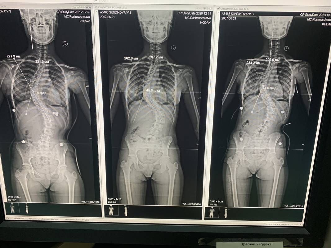 E43BE43F-29C9-42C8-A864-795DCE671D81