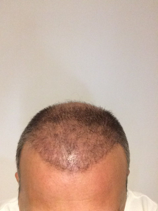 WhatsApp Image 2017-07-17 at 20.52.18